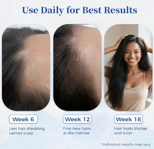 Verea hair growth serum