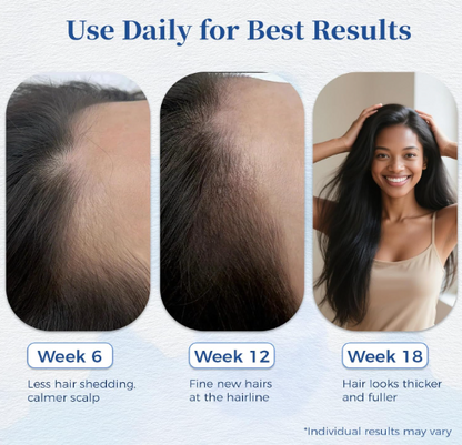 Verea hair growth serum