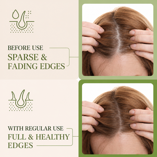 Hair Growth Oil